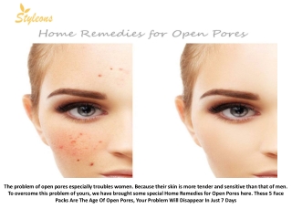 HOME REMEDIES FOR OPEN PORES