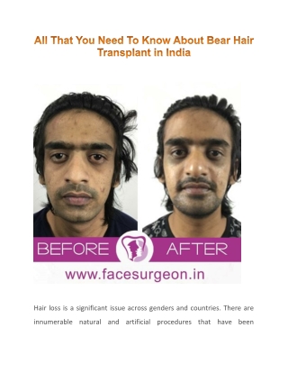 Beard Hair Transplant in India: 5 Things You Must Know
