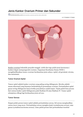 Jenis Kanker Ovarium Primer dan Sekunder - klinikkelaminku.com
