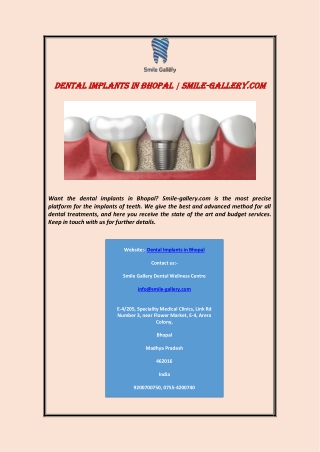 Dental Implants In Bhopal | Smile-gallery.com