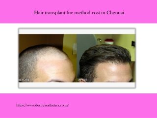 Hair transplant fue method cost in Chennai