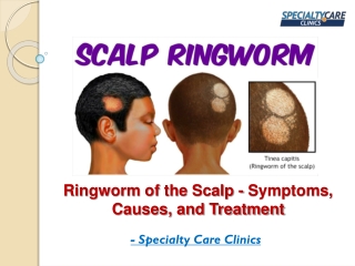 Ringworm of the Scalp - Symptoms, Causes, and Treatment