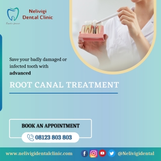 Advanced Root Canal Treatment - Best Dental Clinic Bellandur - Nelivigi Dental