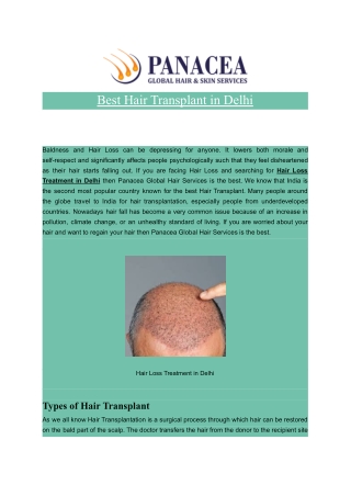 Best Hair Transplant in Delhi