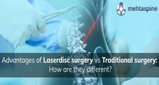 Advantages of Laserdisc Surgery vs Traditional Surgery: How are they different?