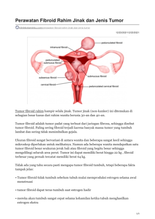 Perawatan Fibroid Rahim Jinak dan Jenis Tumor - klinikkelaminku.com