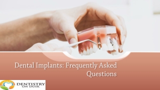 Dental Implants Frequently Asked Questions