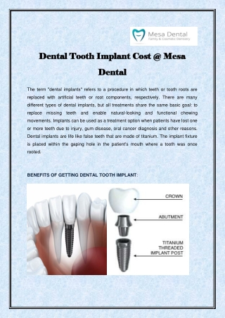 Dental Tooth Implant Cost @ Mesa Dental