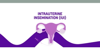 Intrauterine Insemination (IUI) – What You Should Know- Banker IVF
