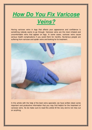 How Do You Fix Varicose Veins