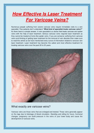 How Effective Is Laser Treatment For Varicose Veins