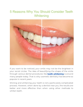 5 Reasons Why You Should Consider Teeth Whitening