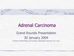 Adrenal Carcinoma