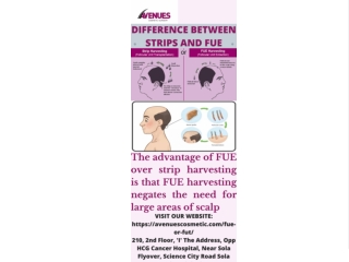 Difference Between Strips And Fue