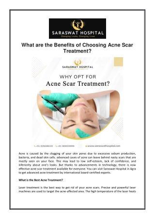 What are the Benefits of Choosing Acne Scar Treatment?