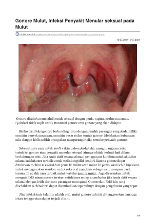 Gonore Mulut Infeksi Penyakit Menular seksual pada Mulut - klinikkelaminku.com