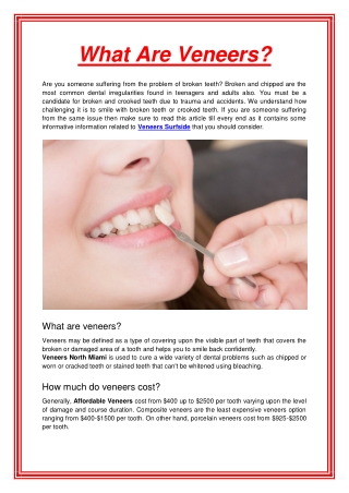 What Are Veneers
