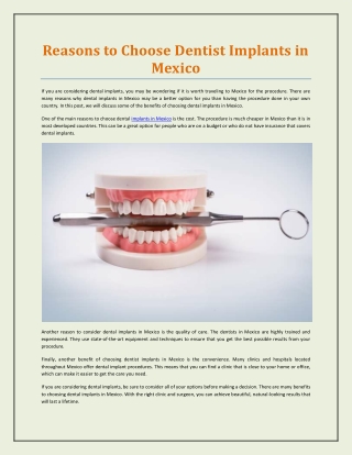 Reasons to Choose Dentist Implants in Mexico