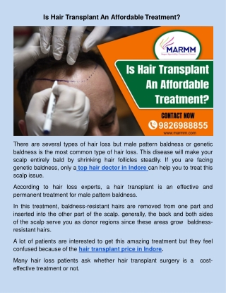 Is Hair Transplant An Affordable Treatment?