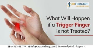 What Will Happen if a Trigger Finger is not Treated? | Dr Chirag Patel