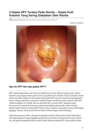 3 Gejala HPV Teratas Pada Wanita Yang Sering Diabaikan - klinikkelaminku.com