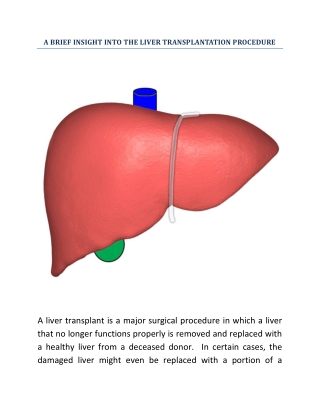 A Brief Insight Into The Liver Transplantation Procedure