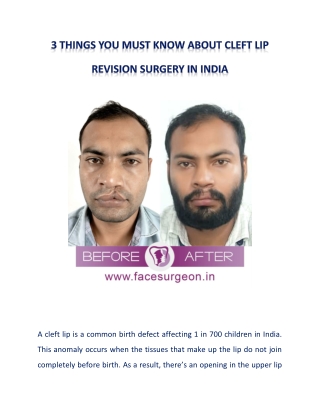 All That You Wanted to Know About Cleft Lip Revision Surgery in India