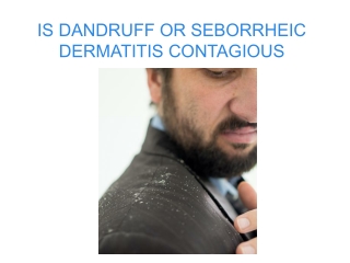 IS DANDRUFF OR SEBORRHEIC DERMATITIS CONTAGIOUS.pptx