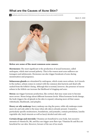 What are the Causes of Acne Skin