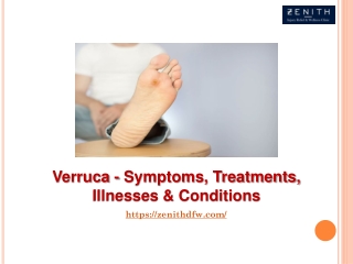 Verruca - Symptoms, Treatments, Illnesses & Conditions