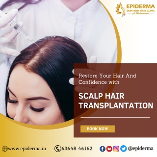 Scalp Hair Transplantation - Best Hair Transplantation in Jayanagar - Epiderma Clinic