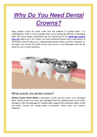 Why Do You Need Dental Crowns