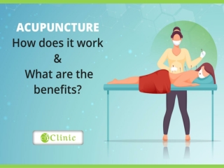 Acupuncture - How does it work & What are the benefits