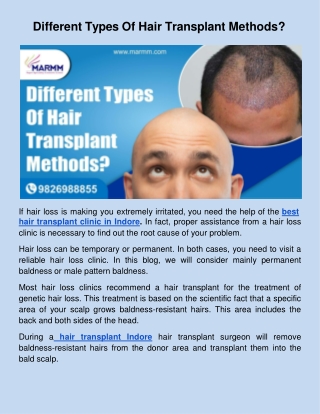 Different Types Of Hair Transplant Methods