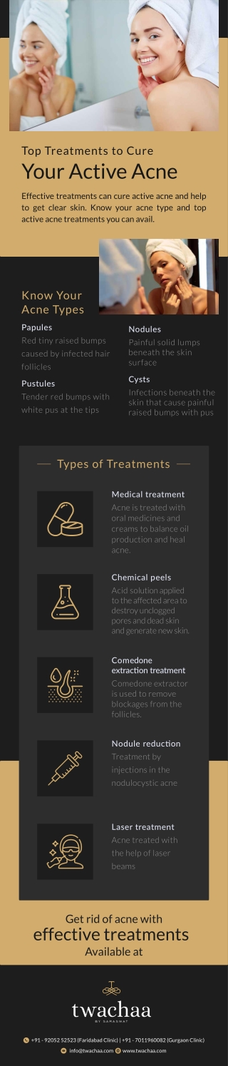 Top Treatments to Cure Your Active Acne