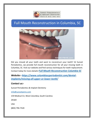 Full Mouth Reconstruction Columbia SC