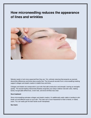 Best Skin Needling in South Hampstead