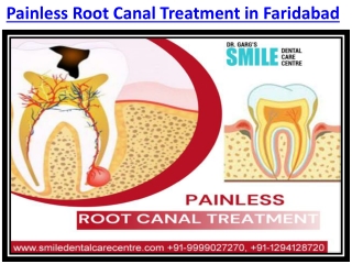 Painless Root Canal Treatment: Everything You Need To Know Before Treatments