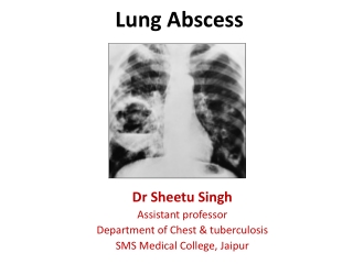 Lung Abscess Dr Sheetu Singh Assistant professor Department of Chest & tuberculosis