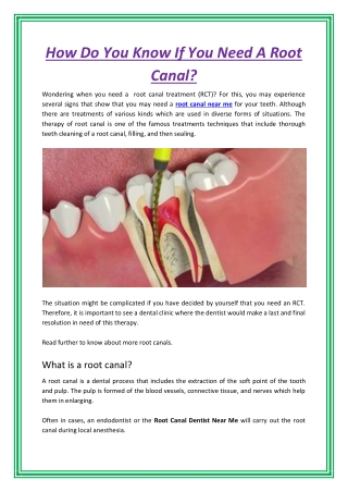 How Do You Know If You Need A Root Canal