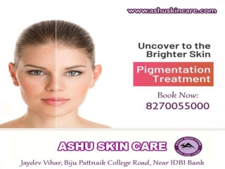 india's Best skin pigmentation treatment clinic in bhubaneswar, odisha