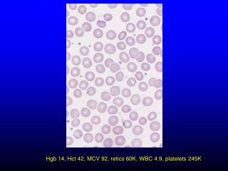 Hgb 14, Hct 42, MCV 92, retics 60K, WBC 4.9, platelets 245K