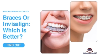 Braces Or Invisalign: Which Is Better - Invisible Braces Kolkata