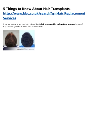 Hair Restoration