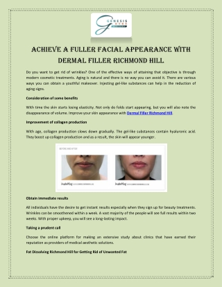 Achieve a Fuller Facial Appearance with Dermal Filler Richmond Hill