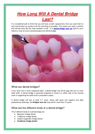 How Long Will A Dental Bridge Last