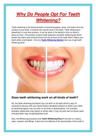 Why Do People Opt For Teeth Whitening