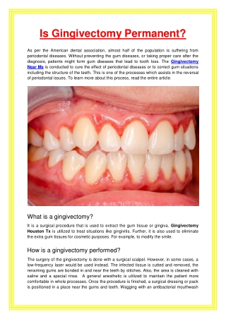 Is Gingivectomy Permanent