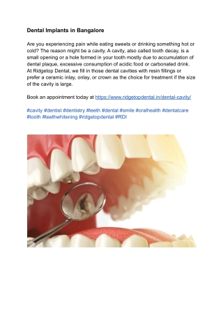 Dental Implants in Bangalore