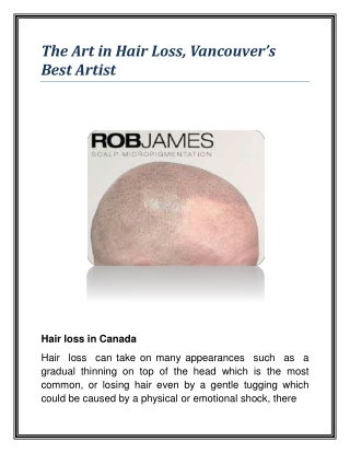 The Art in Hair Loss, Vancouver’s Best Artist